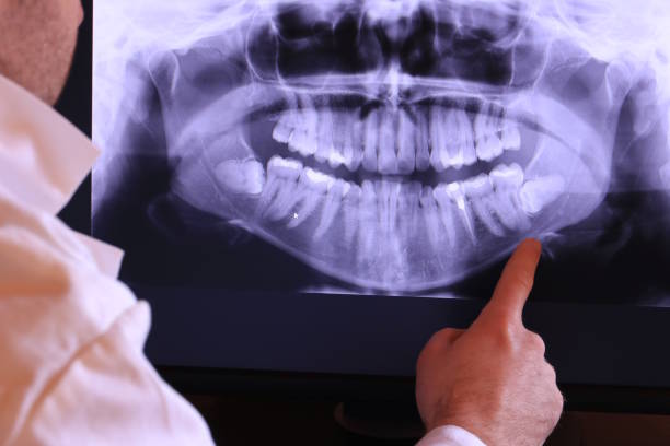 Best Emergency Gum Treatment in Matoaca, VA